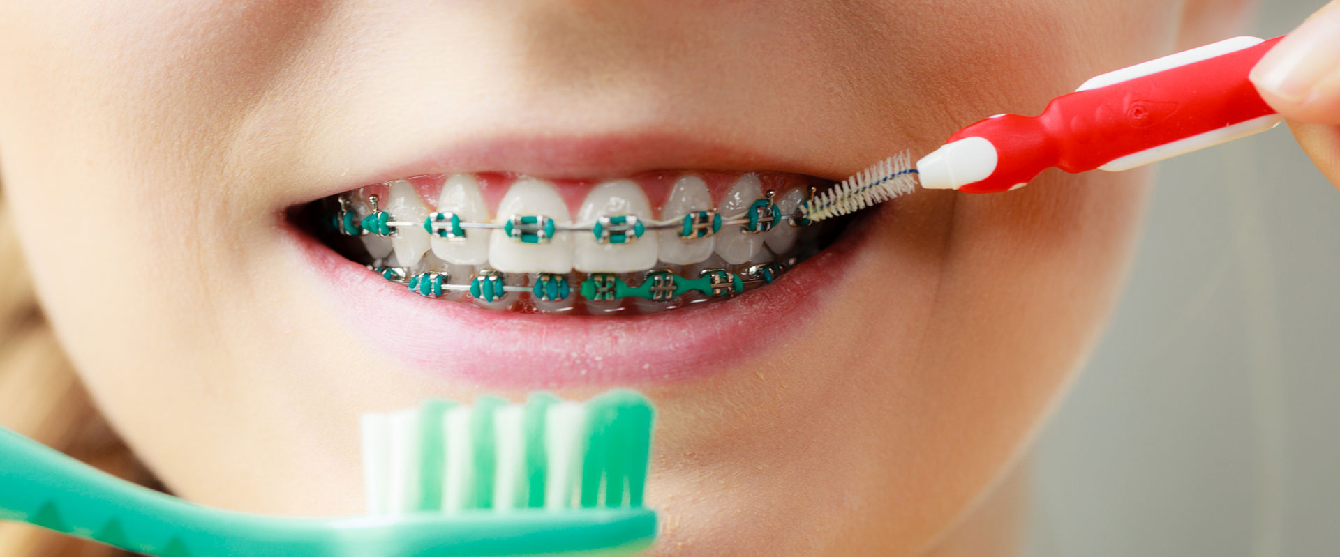 Ortodontik Tedavi Amacı ve Yaş Sınırlaması || Konya Diş Hekimi | Üsame GÜNDÜZ 
