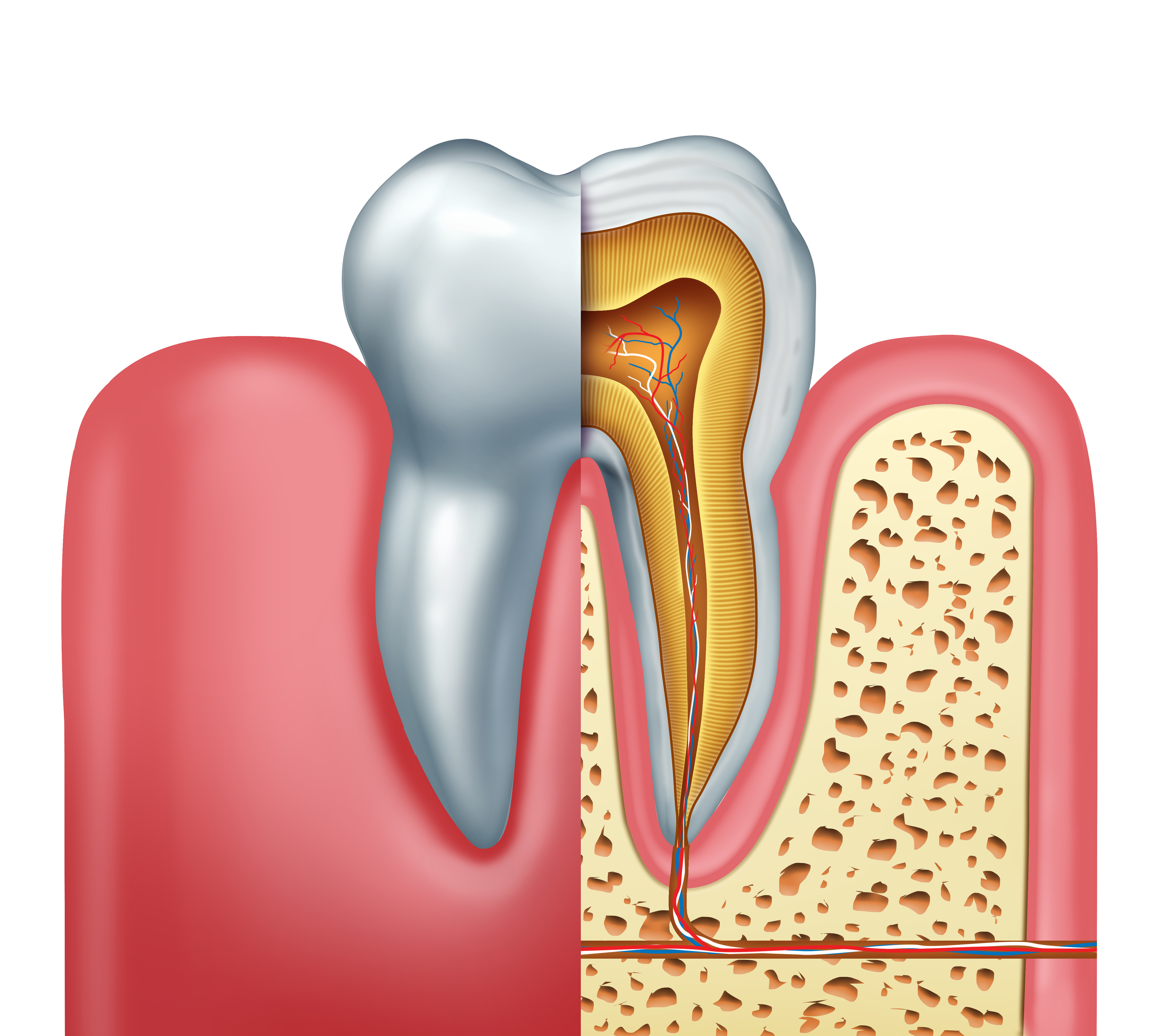 Lezyonlu Dişte Kanal Tedavisi Nasıl Yapılır? || Konya Diş Hekimi | Üsame GÜNDÜZ 