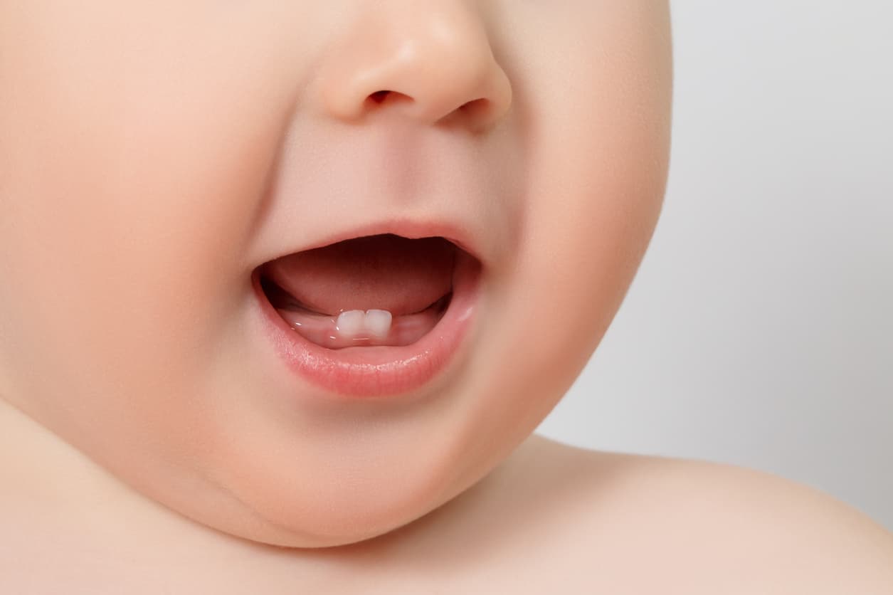 Çocuklarda - Bebeklerde Diş Çıkarma Belirtileri || Konya Diş Hekimi | Üsame GÜNDÜZ 