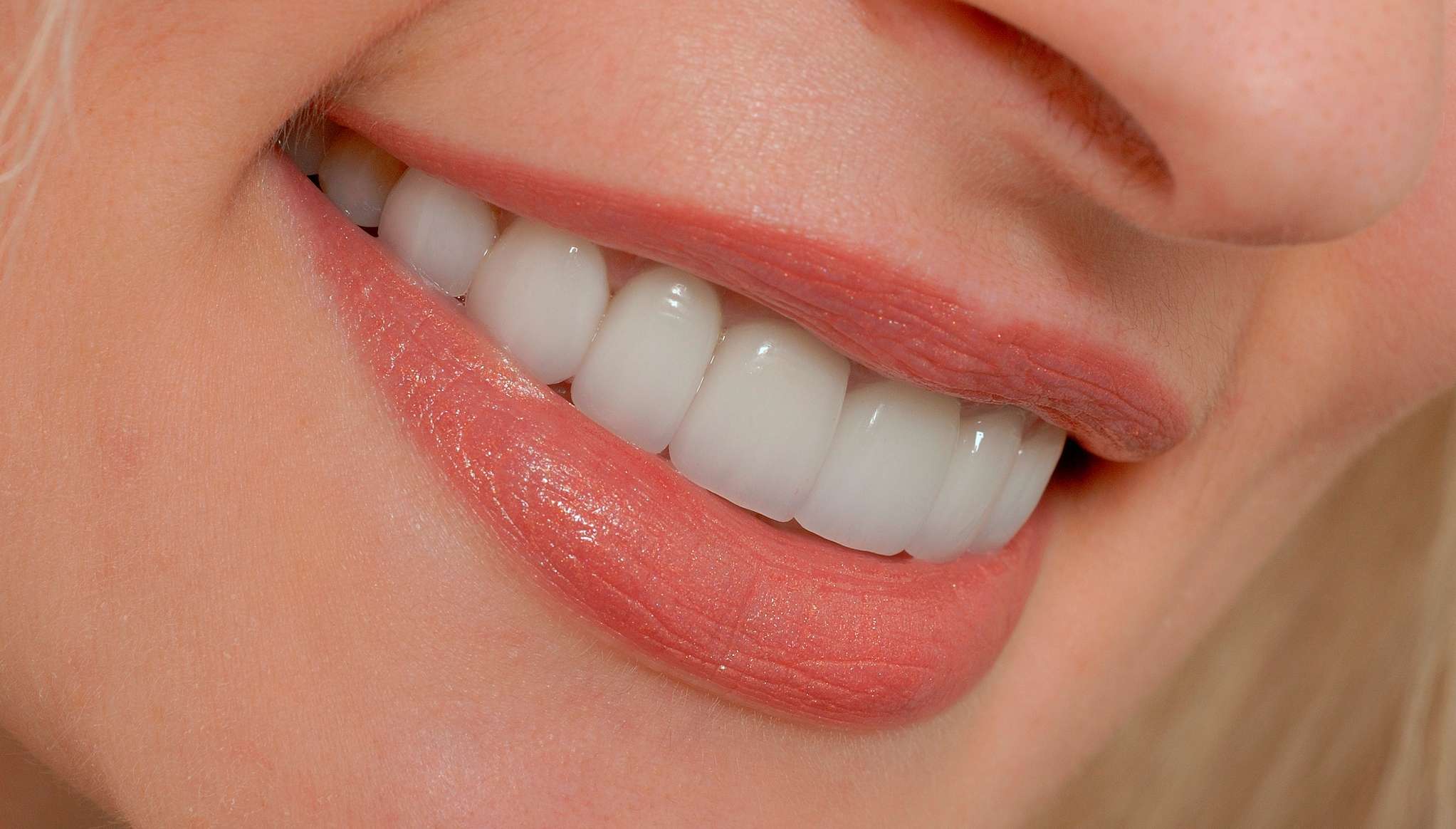 Kuronlar (Kaplamalar - Porselen Dişler) || Konya Diş Hekimi | Üsame GÜNDÜZ 