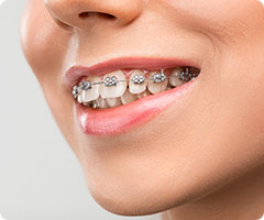  Ortodonti || Konya Diş Hekimi | Üsame GÜNDÜZ